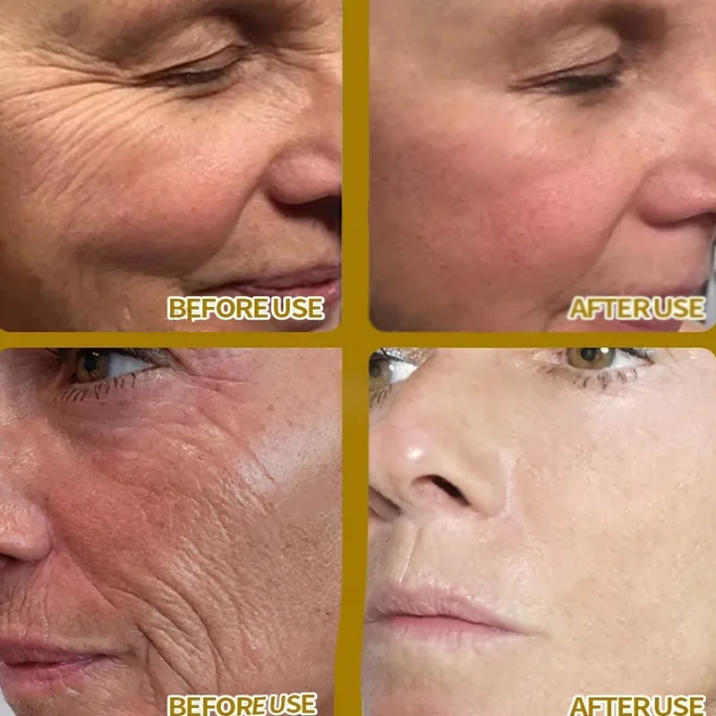 Removedor instantâneo de rugas, soro facial anti-envelhecimento, levantamento, firmador, linhas finas, melhora o embotamento da pele, hidrata, cosméticos coreanos - Imagem 2